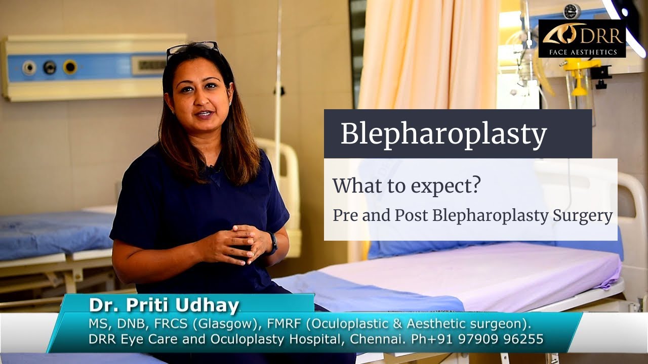 The Recovery Process of Blepharoplasty: What to Expect After Your Procedure? at Visage by Dr Priti, Chennai