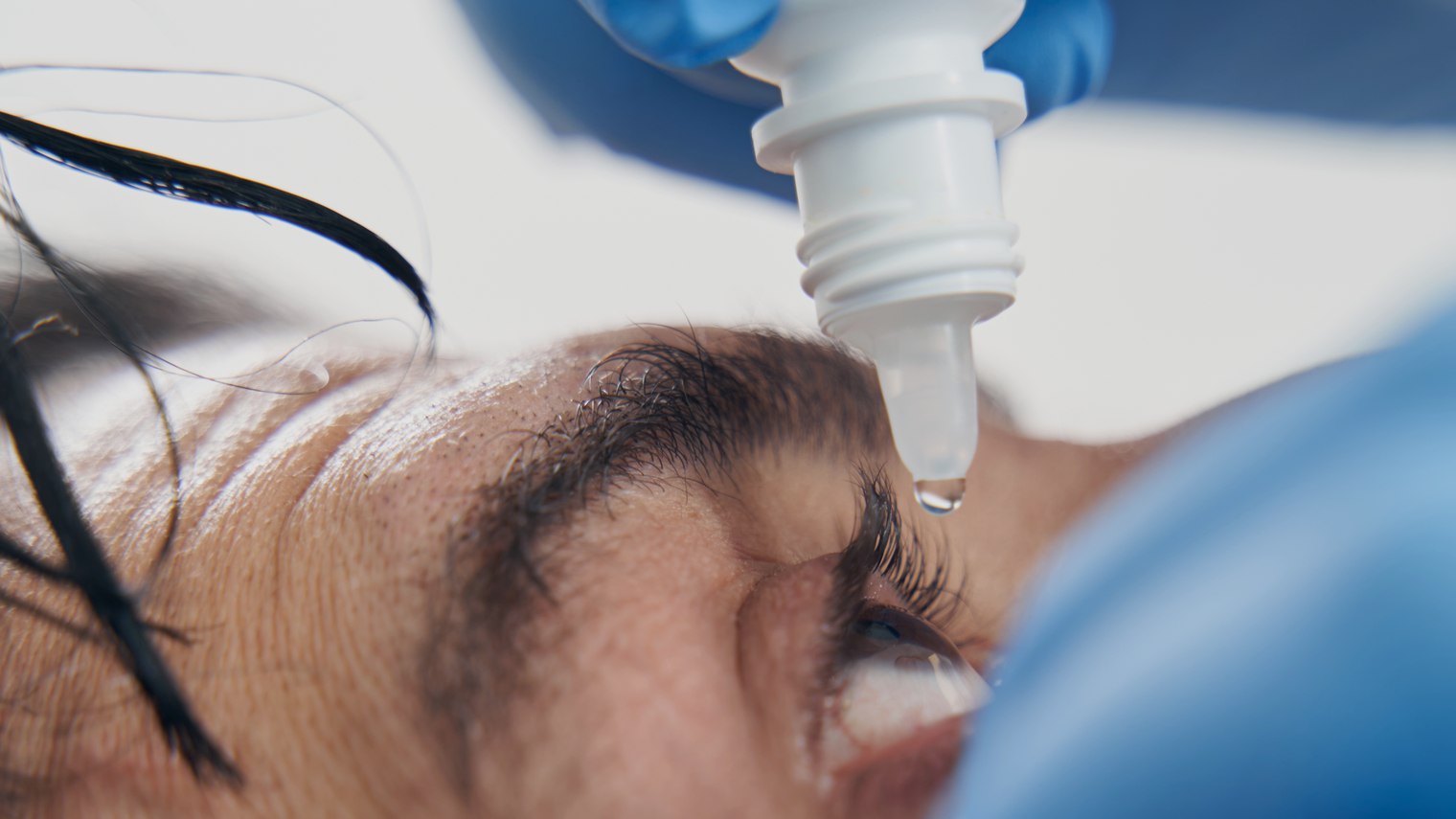 What is Eyelid Ptosis, What Causes It, and What are the Treatment Options? at Visage by Dr Priti, Chennai