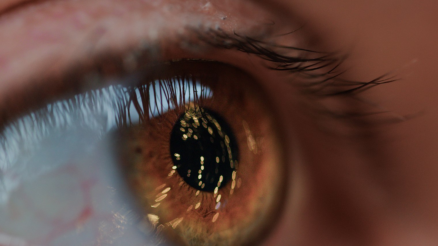 What is Eyelid Ptosis, What Causes It, and What are the Treatment Options? at Visage by Dr Priti, Chennai