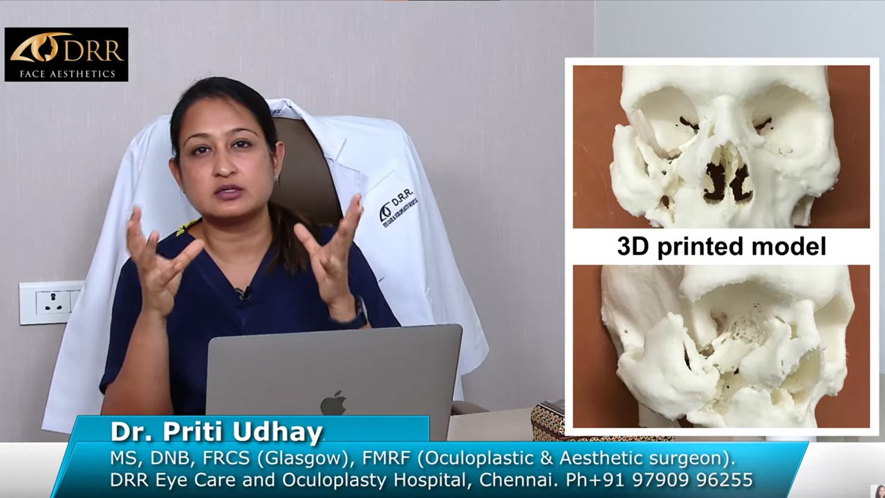 Treating facial deformity and sunken eye with cosmetic correction, Face Reconstruction Surgery at Visage by Dr Priti, Chennai