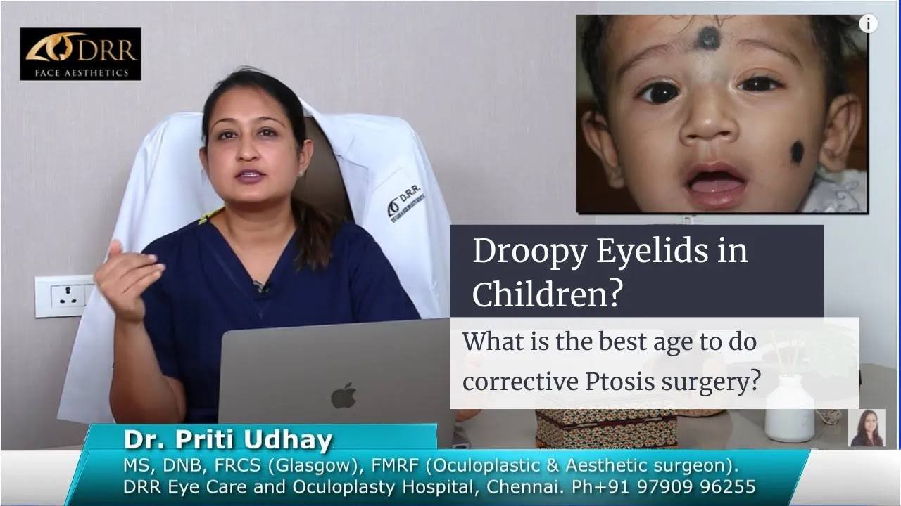 Best Age for Droopy Eyelid (ptosis) Surgery in Children at Visage by Dr Priti, Chennai