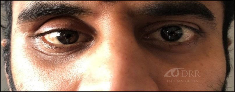 trauma before treatment