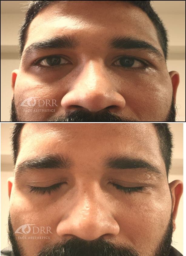 trauma after treatment