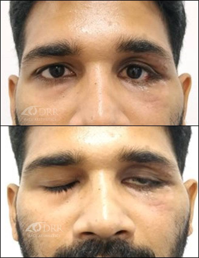 trauma before treatment
