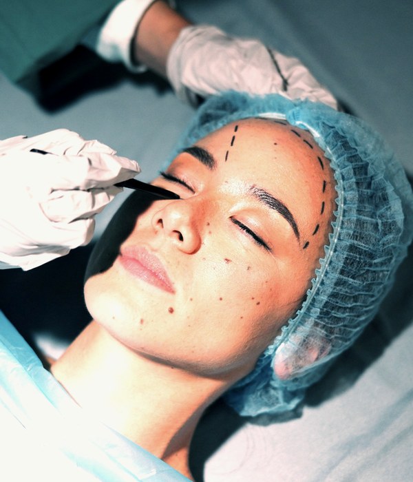 Blepharoplasty treatment being carried out at the clinic