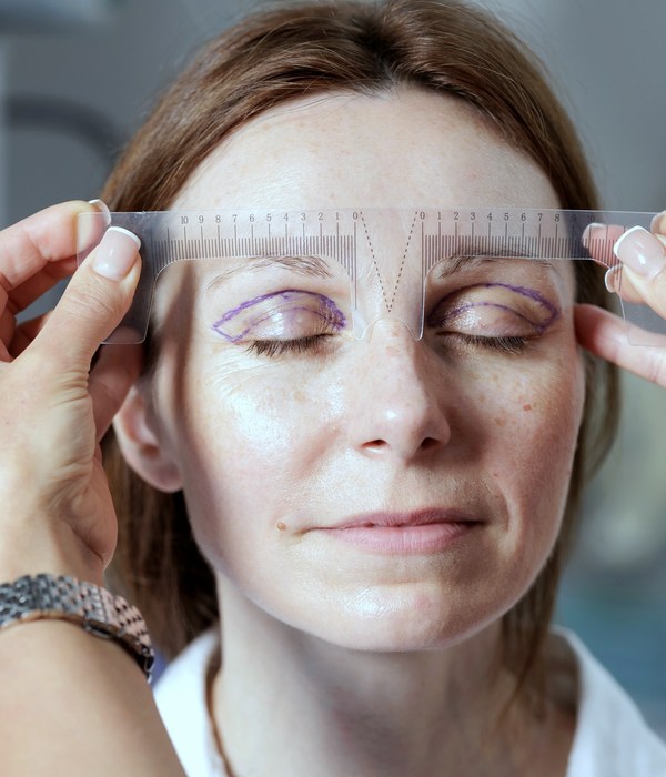 Eyelid Ptosis treatment being carried out at the clinic