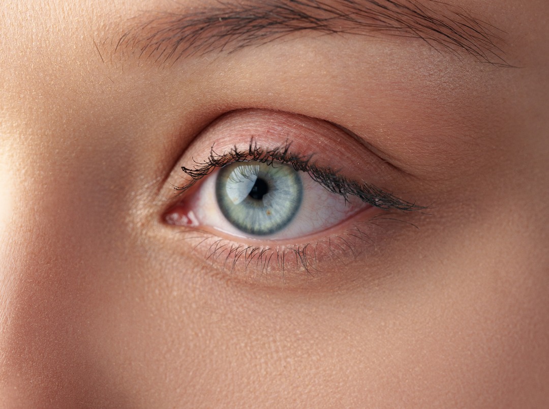 Close view of the eye area affected by blepharoplasty