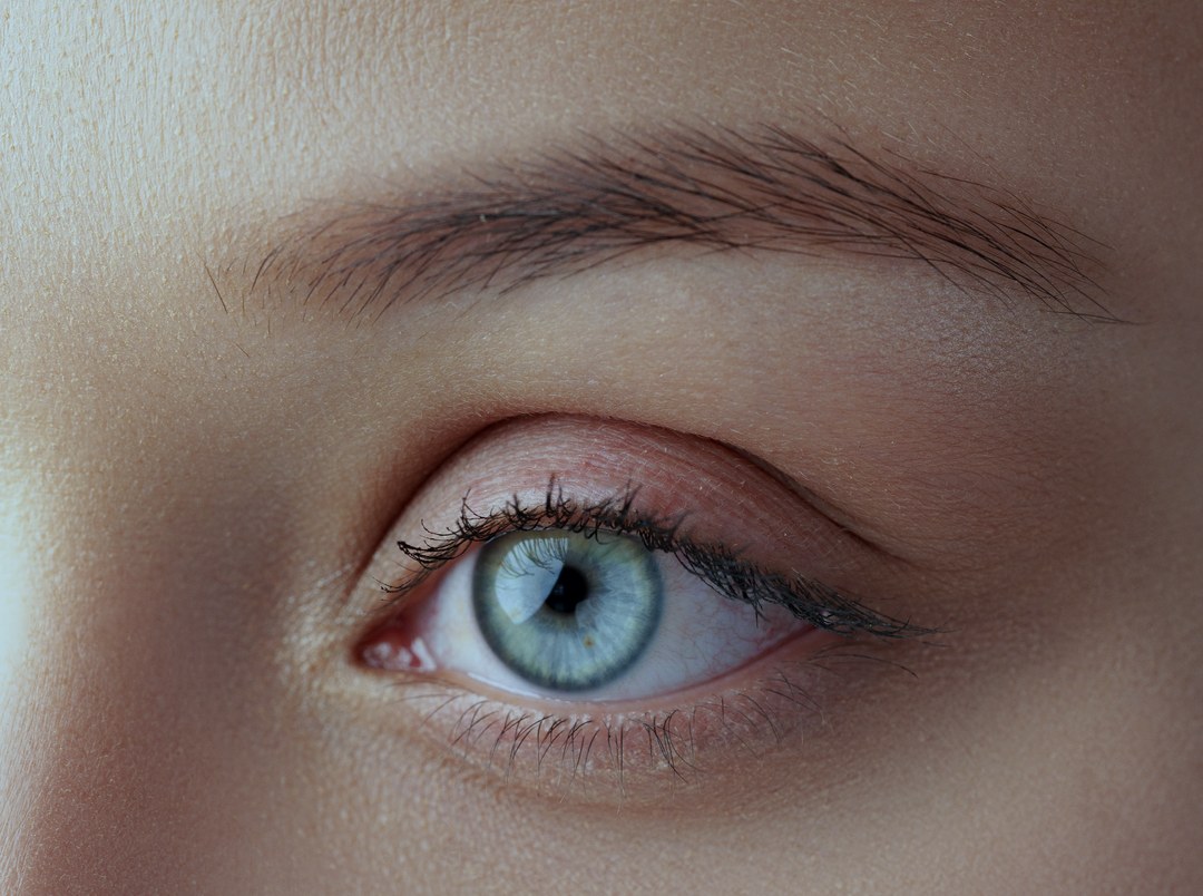 Close view of the eye area affected by bulgy eyes