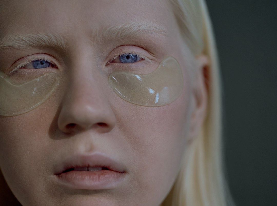 Close view of the eye area affected by dark circles