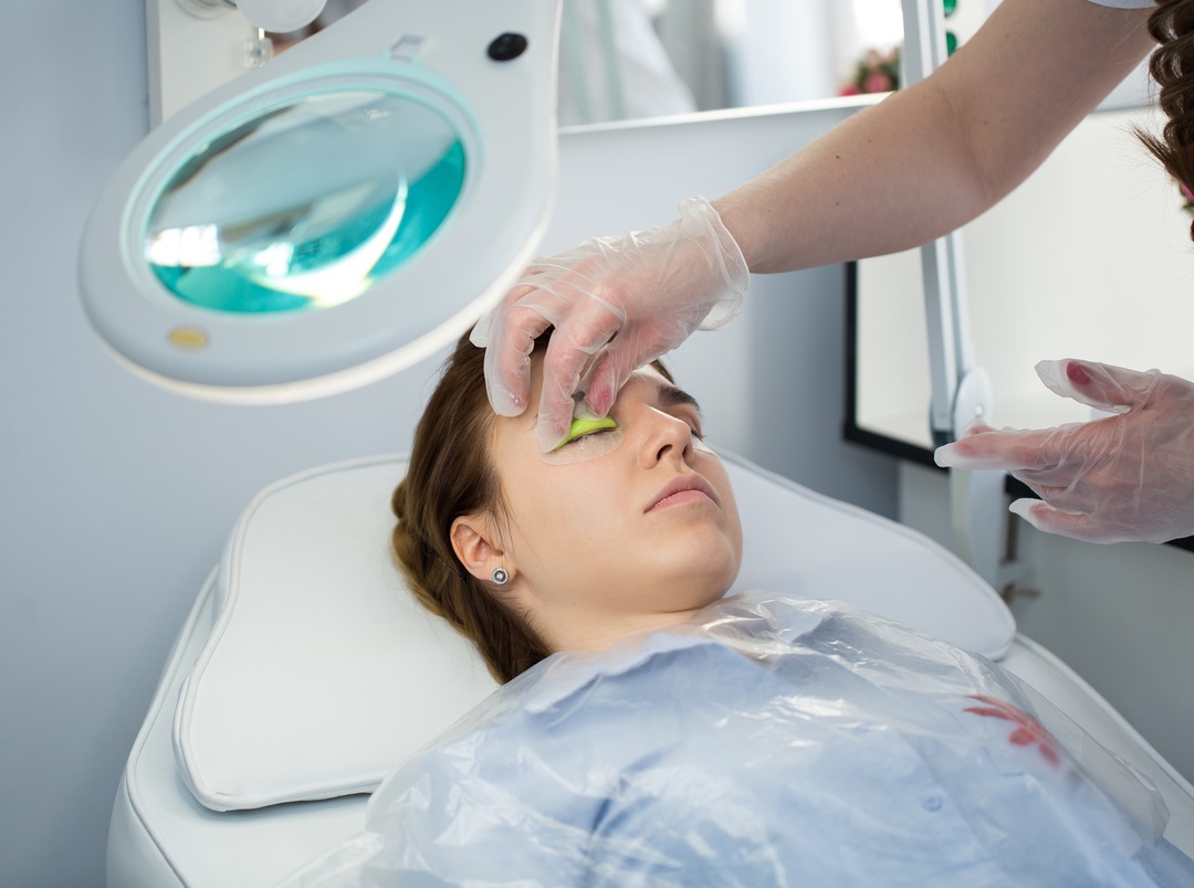 Close view of the eye area affected by sunken eyes