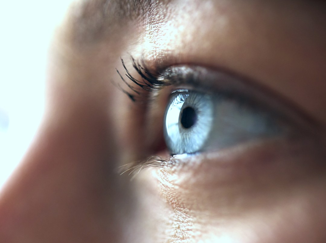 Close view of the eye area affected by thyroid eye disease