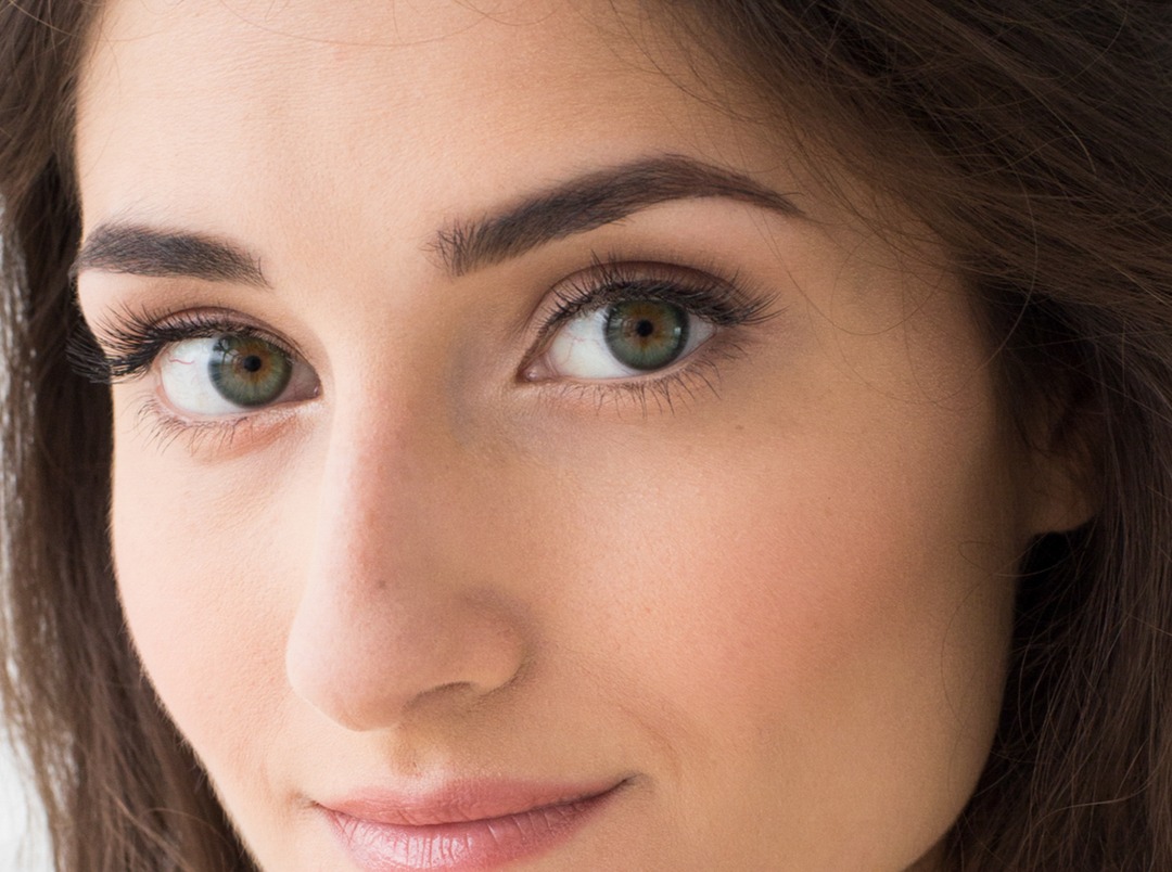 Close view of the eye area affected by under eye bags
