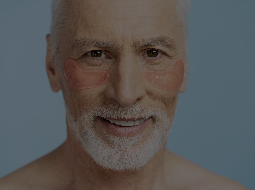 Close view of the eye area affected by xanthelasma